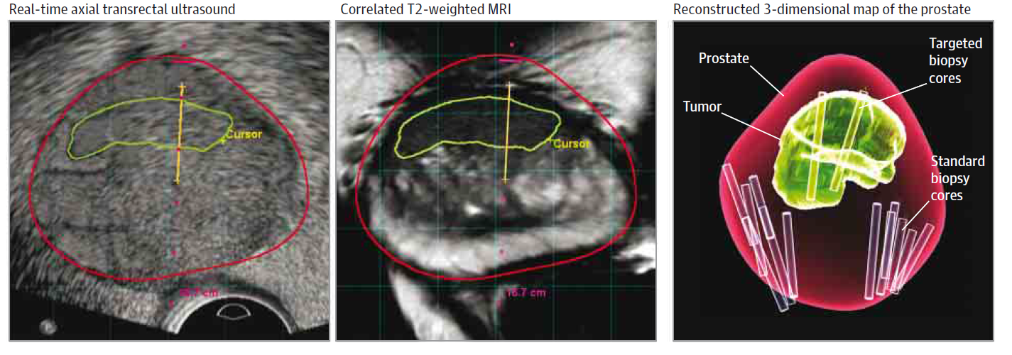 Ultrasound image